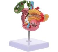 Cirugía Sistema de gastroenterología Modelo hepatobiliar Modelo patológico de la vesícula biliar Modelo de enseñanza de biología Páncreas médico Páncreas Duodeno Modelo patológico de la vesícula