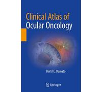 Clinical Atlas of Ocular Oncology