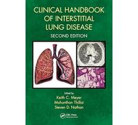 Clinical Handbook of Interstitial Lung Disease