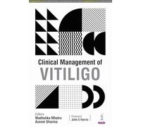 Clinical Management of Vitiligo