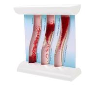 CLISPEED Modelo Vascular Modelo Del Sistema Circulatorio Vaso Sanguíneo Modelo De Vasos Sanguineos Anatomía Humana Modelo De Anatomía Modelos De Anatomía Modelo Anatómico Humano Acrílico