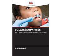 Collagénopathies: IMPLICATIONS EN MATIÈRE DE SANTÉ BUCCO-DENTAIRE