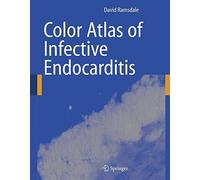 Color Atlas of Infective Endocarditis by David R. Ramsdale (2005-12-13)