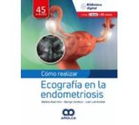 Cómo Realizar Ecografía En La Endometriosis