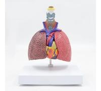 Comparación pulmón fumador y pulmón sano con tarjeta instructiva丨Modelo corazón-árbol bronquial de 5 piezas, herramienta didáctica de anatomía cardiopulmonar para estudio respiratorio