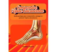 Comprendre l'Épine Calcanéenne: Le guide complet pour soulager durablement la douleur du talon.