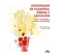Concentrado De Plaquetas Fibrina Y Leucocitos. Uso En Odontologia Y En