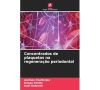 Concentrados de plaquetas na regeneração periodontal