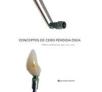 Conceptos de Cero Pérdida Ósea