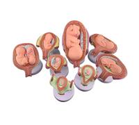 Conjunto de modelos de desarrollo de embriones humanos de 8 piezas, modelo de proceso de desarrollo de embriones de embarazo, con piezas extraíbles, desarrollo de embriones humanos/fetos en el útero
