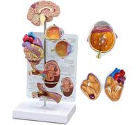 Conjunto De Modelos De Hipertensión: Réplicas De Anatomía Humana En Miniatura del Cerebro, Ojo, Corazón Y Arteria como Herramienta Educativa sobre La Presión Arterial Alta