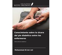Conocimiento sobre la úlcera del pie diabético entre los enfermeros: Úlcera del pie diabético