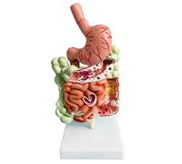 Cpolebev Modelo de Digestivo Humano AnatomíA del EstóMago Intestino Grueso Ciego Recto Duodeno Modelo de Estructura de óRganos Internos Humanos