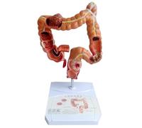 Cpolebev Modelo de Enseñanza, Modelo de Anatomía del Intestino Grueso Humano Modelo de Lesión Visceral Modelo de Aprendizaje del Digestivo Humano
