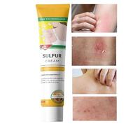 Crema Anti-Picor, Crema para el Cuidado de la Irritación 20g, Ungüento Picor Piel Seca Grasa Sensible Hogar Exterior Camping Salon Post Entrenamiento