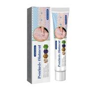 Crema Antifúngica,Tratamiento Eficaz Contra la Tiña, el eccema,Alivia Rápidamente los Irritación Y Enrojecimiento en el Cuerpo,Pie De Atleta, Alivia la Picazón,Antifúngico (1)