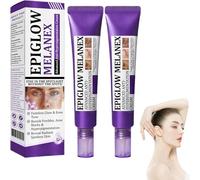 Crema antihiperpigmentación avanzada, crema de eliminación de pigmentación iluminadora, limpieza profunda de manchas oscuras