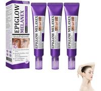 Crema antihiperpigmentación avanzada, crema de eliminación de pigmentación iluminadora, limpieza profunda de manchas oscuras