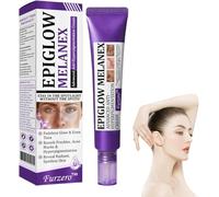 Crema antihiperpigmentación avanzada, crema de eliminación de pigmentación iluminadora, limpieza profunda de manchas oscuras