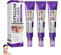 Crema antihiperpigmentación avanzada, eliminador de manchas oscuras para rostro y cuerpo, para el tratamiento de la hiperpigmentación, manchas oscuras y melasma.