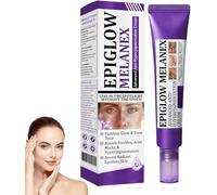 Crema Antihiperpigmentación Avanzada, Eliminador de Manchas para Rostro y Cuerpo, para el Tratamiento de la Hiperpigmentación