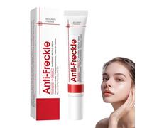 Crema blanqueadora de pecas, eliminación de manchas de pigmento facial, crema contra manchas de pigmento, anti manchas de pigmentación facial, eliminación de manchas de edad (1)