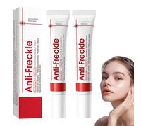 Crema blanqueadora de pecas, eliminación de manchas de pigmento facial, crema contra manchas de pigmento, anti manchas de pigmento facial, eliminación de manchas de edad (2)