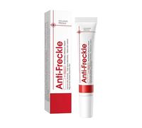 Crema blanqueadora para eliminar manchas de pigmento facial, crema blanqueadora contra manchas oscuras en cremas para eliminar manchas pigmentadas faciales, crema blanqueadora para pecas (1 unidad)