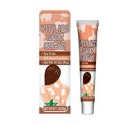 Crema de manchas blancas - Crema Aliviadora de Vitiligo 20 G Contra Las Manchas Blancas En La Piel | Crema Repigmentadora Y Eliminadora, Fácil De Aplicar, Mejora La Pigmentación De La Piel En Vitiligo