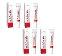 Crema de Manchas Faciales,Crema para Eliminar Manchas Pigmentadas,20g*4pc,Blanqueamiento y Maquillaje
