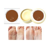 Crema De Manos Secas - Loción Reparadora de Talones Anti-Congelante | Loción Hidratante Para Manos Secas,Para Piel Muerta Pies Asperos Hombres Jóvenes Ancianos Atletas Dedos Sanos Codos