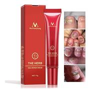 Crema de Uñas a Base de Hhierbas, Protector Crema de Cuidado de la Piel Ungüento Tratamiento Uñas de Uñas Onicomicosis Paroniquia Tratamiento Antimicótico Crema de Reparación de Uñas, 15g