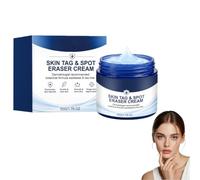 Crema eliminadora de 7 días para eliminar las manchas y la piel para eliminar las manchas de la piel y el cuerpo, para todo tipo de pieles, 1 unidad