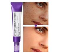 Crema Facial Anti Hiperpigmentación, Crema Facial Iluminadora 30 Gramos, Loción Hidratante para Eliminar Manchas en Mujeres