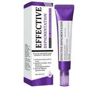 Crema facial antihiperpigmentación | 30 g Loción facial nutritiva - Loción facial hidratante con aclarador eliminación de manchas para adultos