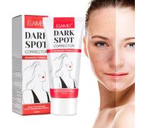Crema Hidratante Aclarante y Anti Manchas, Dark Spot Corrector Remover, Tratamiento Antienvejecimiento y Blanqueador para Manchas Oscuras, Crema Blanqueadora de Piel para Rostro y Cuerpo