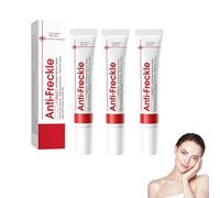 Crema para Eliminar Manchas Oscuras en la Cara, Removedor de Manchas de Pigmentación Facial, Crema Contra Manchas Oscuras, Ilumina la Piel, Cuidado Diario de la Piel (3)