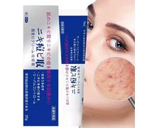 Crema para Granos,Crema Eliminadora De Granos 20g,Loción Ungüento Corrector Reparación Facial Hidratante Nutritivo Calma Seca Sensible Control Brillo Cicatrices Hombres Mujeres - Con Acción Calmante E
