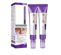 Crema para la hiperpigmentación, eliminador de manchas oscuras para rostro y cuerpo, crema para eliminar la pigmentación, reduce la hiperpigmentación y mejora el tono de la piel.