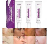 Crema para Las Manchas de La Cara, Cremas para Quitar Manchas de La Cara, Crema Blanqueadora para Pecas, Elimina el Melasma Manchas Oscuras Aclara La Piel