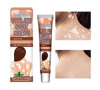 Crema Piel para Vitíligo, Crema Repigmentación y Alivio del Vitíligo 20g, Reduce las manchas blancas, mejora los melanocitos epidérmicos, restaura el vitíligo la piel