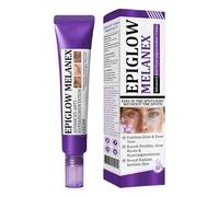 Creme Gegen Pigmentflecken | Pigmentfleckenentfernungscreme Fürs Gesicht | Nicht Fettende Farbkorrektur - Hautpflegeprodukte Für Zuhause, Hochzeit, Date, Reisen Und Die Nacht