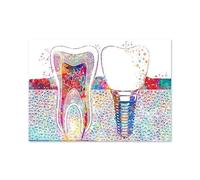 Cuadro de arte Dental, lienzo implante dientes, impresión pared dentista, póster medicina higienista, decoración clínica acuarela(A,40X60cm No Frame)