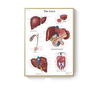 Cuadro de patología, carteles enfermedades anatómicas e impresiones, lienzo, pintura artística, cuadros pared for decoración sala estar, del hogar(J,30X40cm No Frame)