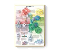 Cuadro de patología, carteles enfermedades anatómicas e impresiones, lienzo, pintura artística, cuadros pared for decoración sala estar, del hogar(I,50X70cm No Frame)