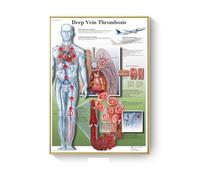 Cuadro de patología, carteles enfermedades anatómicas e impresiones, lienzo, pintura artística, cuadros pared for decoración sala estar, del hogar(H,40X50cm No Frame)