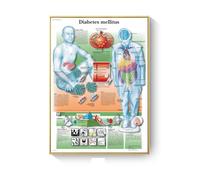 Cuadro de patología, carteles enfermedades anatómicas e impresiones, lienzo, pintura artística, cuadros pared for decoración sala estar, del hogar(O,40X50cm No Frame)