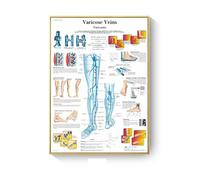Cuadro de patología, carteles enfermedades anatómicas e impresiones, lienzo, pintura artística, cuadros pared for decoración sala estar, del hogar(G,15X20cm No Frame)