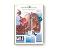 Cuadro de patología, carteles enfermedades anatómicas e impresiones, lienzo, pintura artística, cuadros pared for decoración sala estar, del hogar(A,21X30cm No Frame)