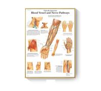 Cuadro de patología, carteles enfermedades anatómicas e impresiones, lienzo, pintura artística, cuadros pared for decoración sala estar, del hogar(E,50X70cm No Frame)